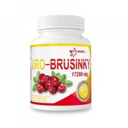 URO-BRUSINKY tbl.60