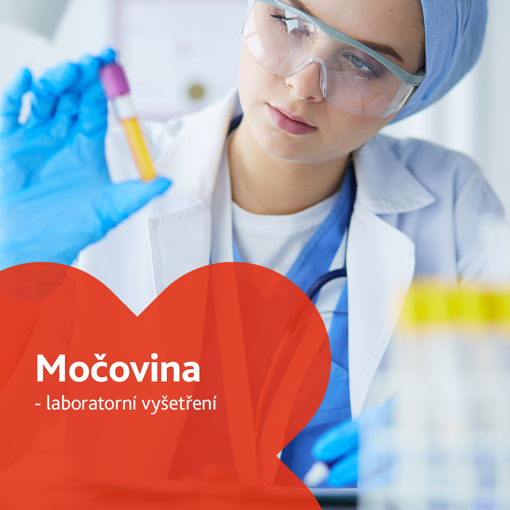 Močovina (Urea) - laboratorní vyšetření